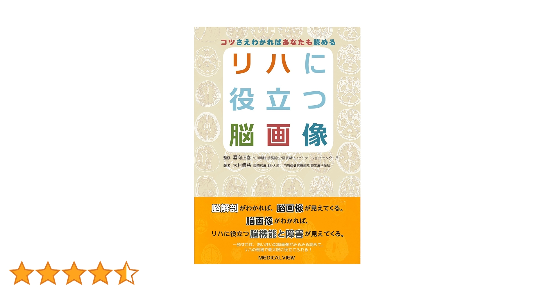 コツさえわかればあなたも読める リハに役立つ脳画像 | 大村 優慈, 酒